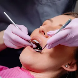 Cleaning & Prevention