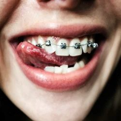 Orthodontics